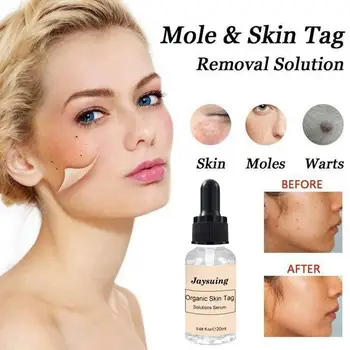 

VIBRANT GLAMOUR 10/20ML Organic Tags Solutions Serum Mole Skin Tag Removal Solution Painless Spots Remover