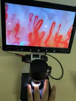 

2020 best seller 10 inch Microcirculation microscopic observation instrument nail wall tip flow velocity tester