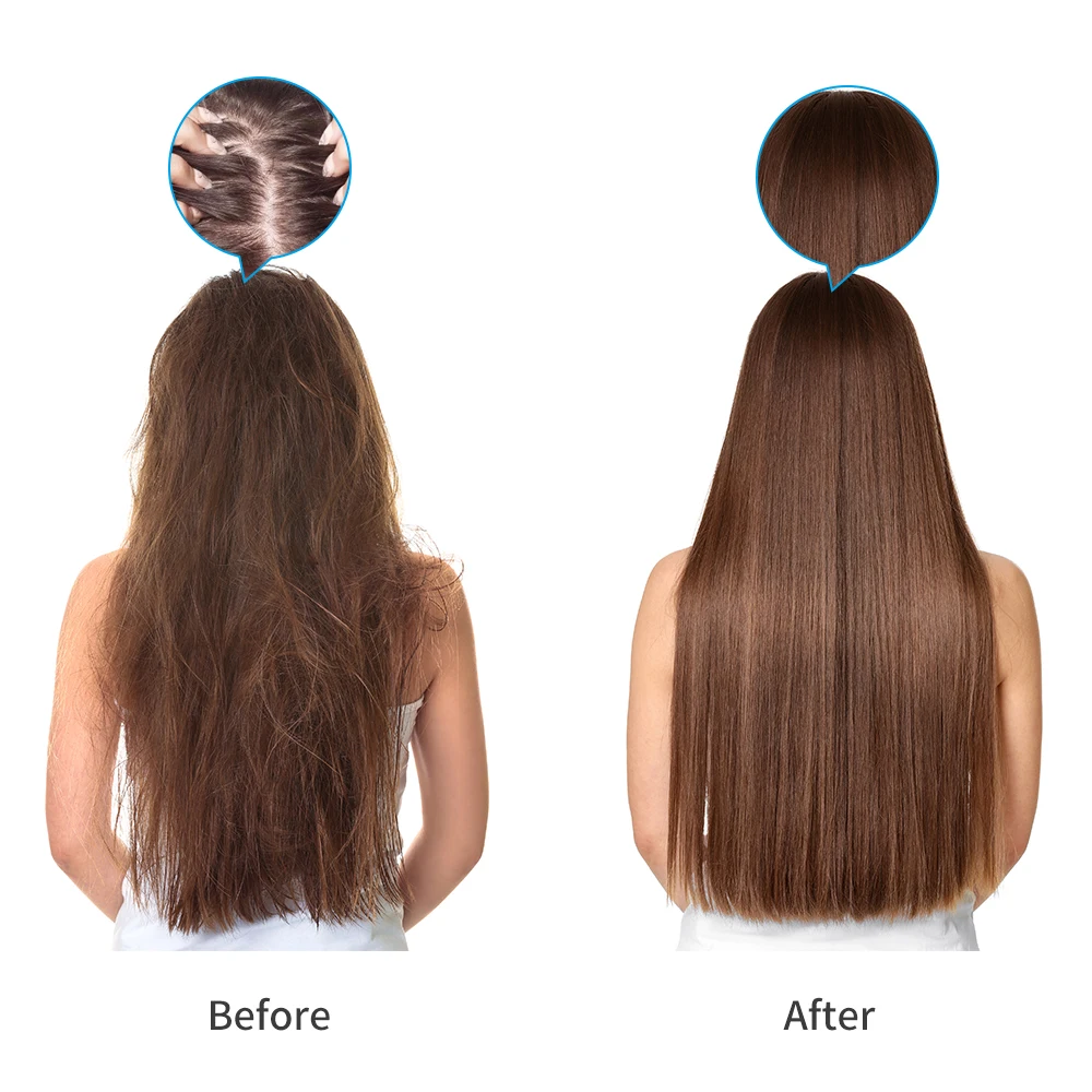 Pettine per massaggio alla testa e al cuoio capelluto con laser elettrico Spazzola per la crescita dei capelli Terapia con agopuntura a infrarossi Forniture per lo styling della perdita dei capelli Salute_voghion.com
