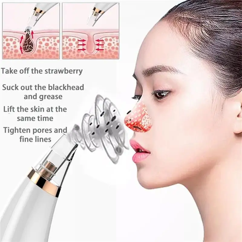 

Blackhead remover pore vacuum acne pimple removal vacuum suction tool nose face deep cleansing machine clean skin care tools