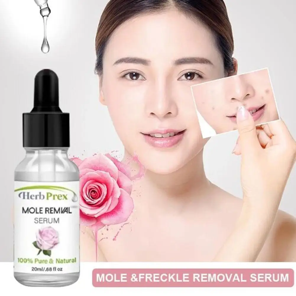 

20ml Liquid Wart Mole Removal Serum Organic Tags Solutions Fast Remover Essence Spot Serum Skin Painless Mole Care Freckle P0B3