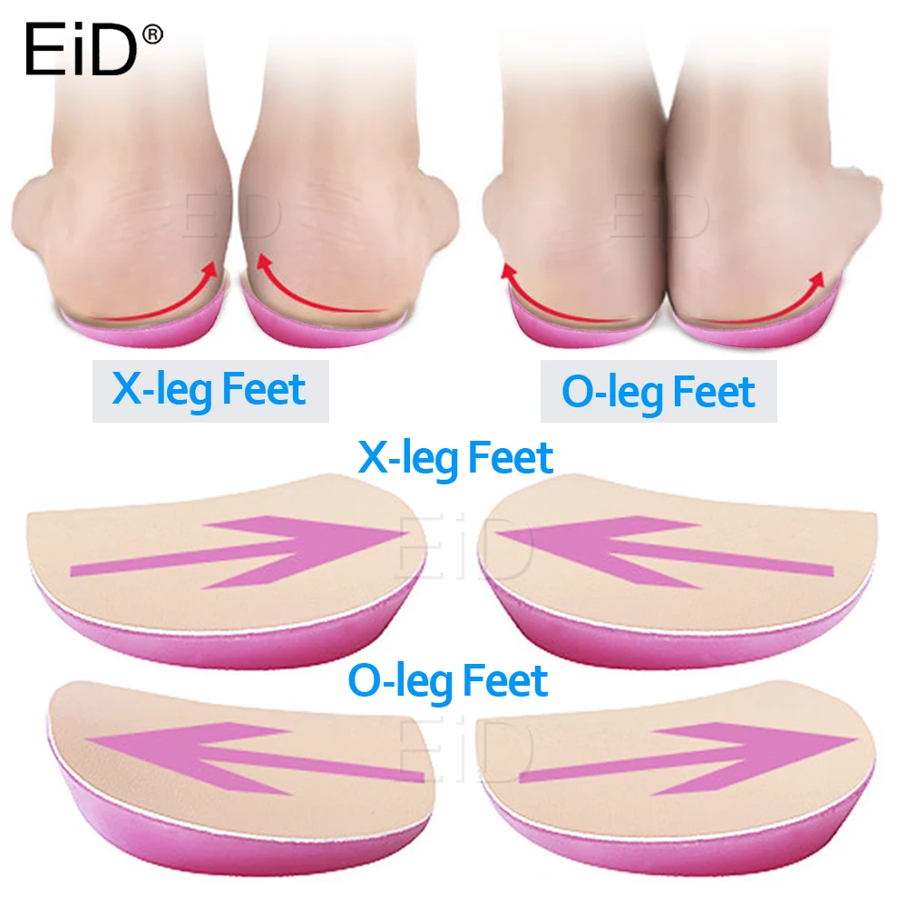 Xo脚整形外科靴インソールシリコーンゲルアーチサポート女性のためのフラット足矯正挿入痛みを軽減する高ヒールパッド Inserts Cushions Aliexpress