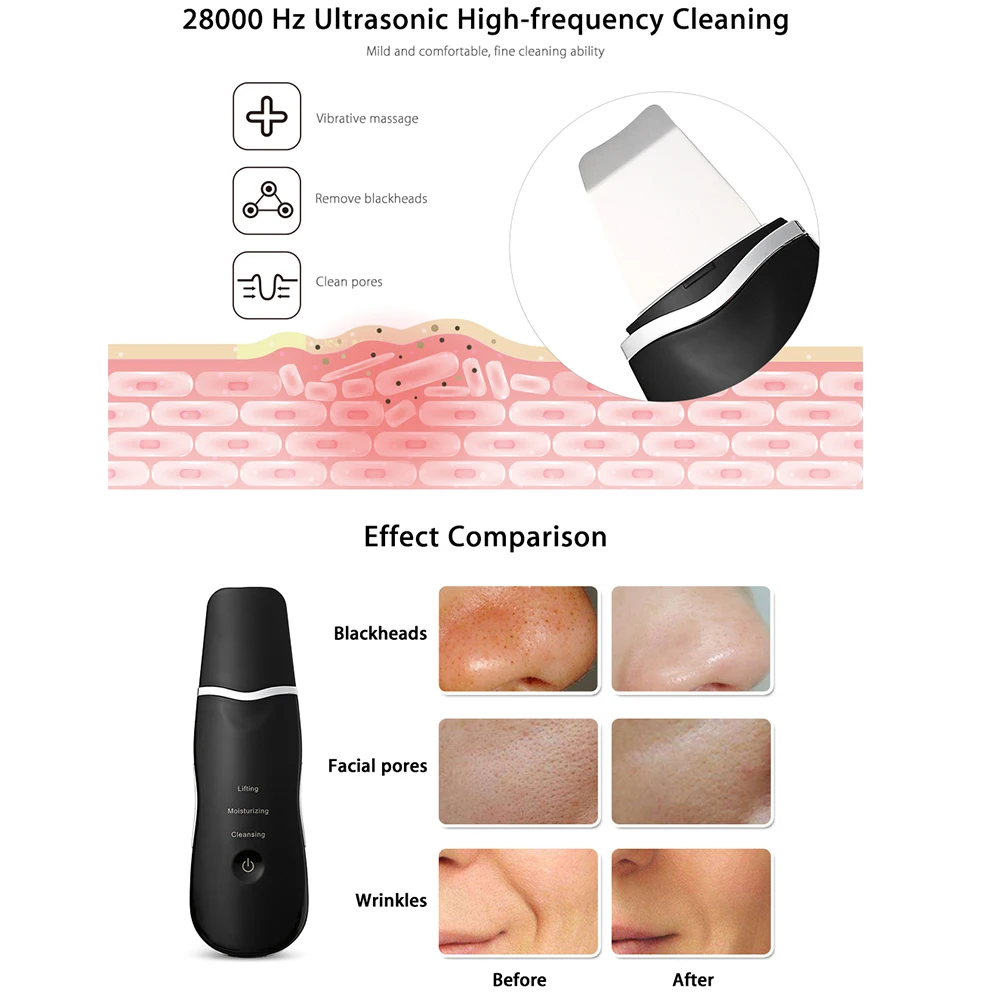Powered Facial Cleansing Devices Spatula Peeling Ultrasonic Skin Scrubber Face Deep Cleaning Sonic Vibration Face Skin Care Tool