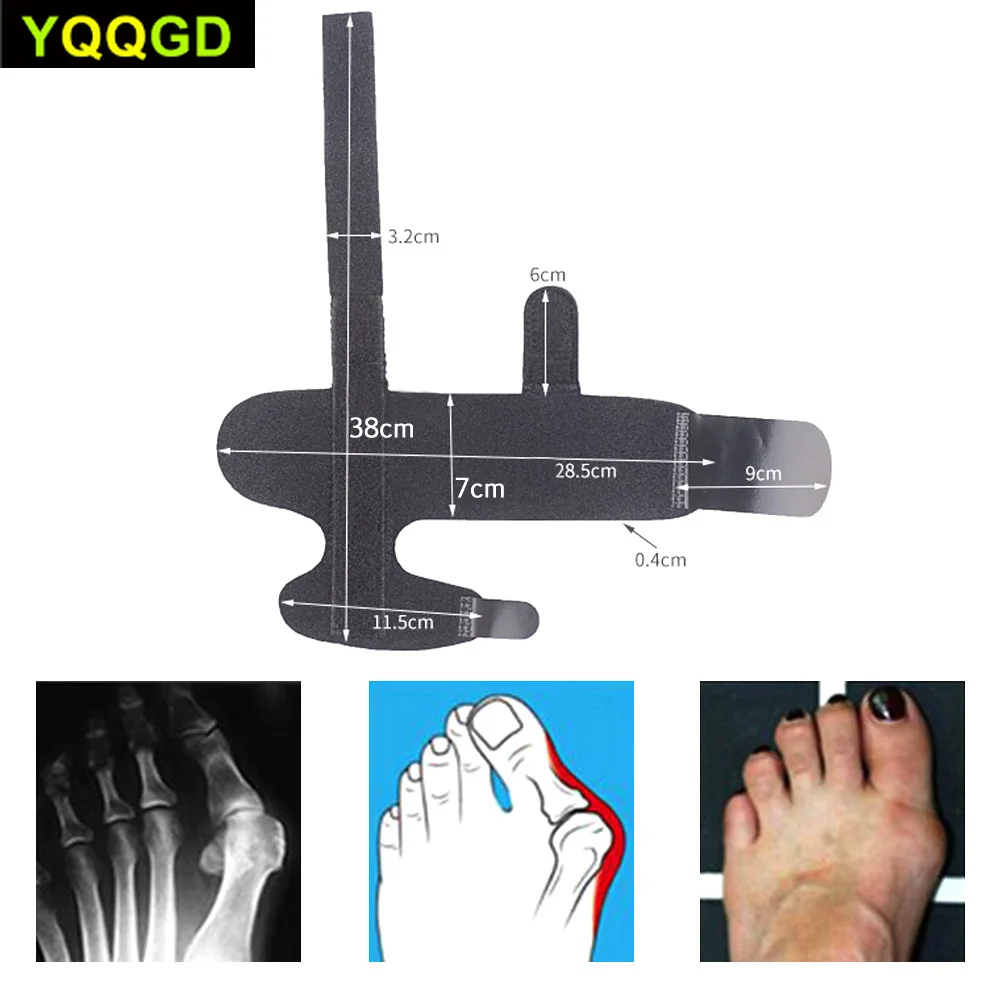 1Pcs Bunion Splint Toe Straightener & Corrector Brace Pad for Hallux Valgus Pain Relief -Day Night Time Support for Men & Women 1Pcs Bunion Splint Toe Straightener & Corrector Brace Pad for Hallux Valgus Pain Relief -Day Night Time Support for Men & Women