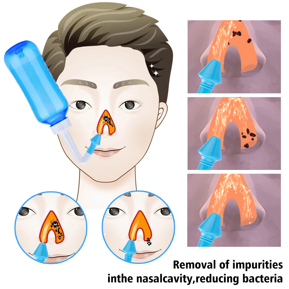 300ml Nasal Wash Sinusitis Nose Cleaner for Adults Child Allergic Rhinitis Treatment Nasal Irrigator Neti Pot Nose Cleaning Tool nasal irrigator set baby nose cleaning tools