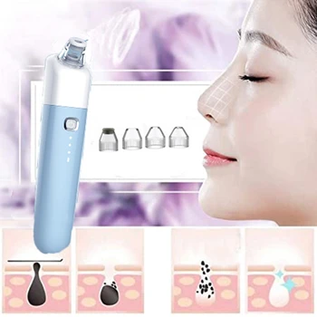

Blackhead Removal Vacuum Cleaner-USB Rechargeable Head Device-Static Vacuum Acne Extractor for All Skin Types