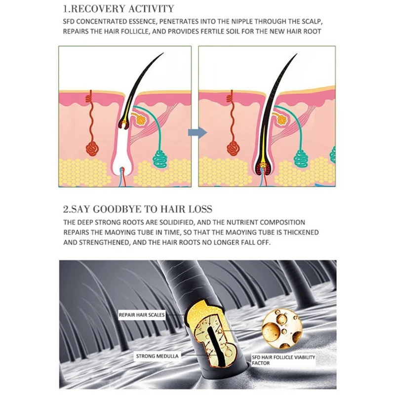 Сыворотка против выпадения волос, эссенция быстрого роста, натуральные густые волосы для роста, Эфирная жидкость для выпадения волос, серия продуктов