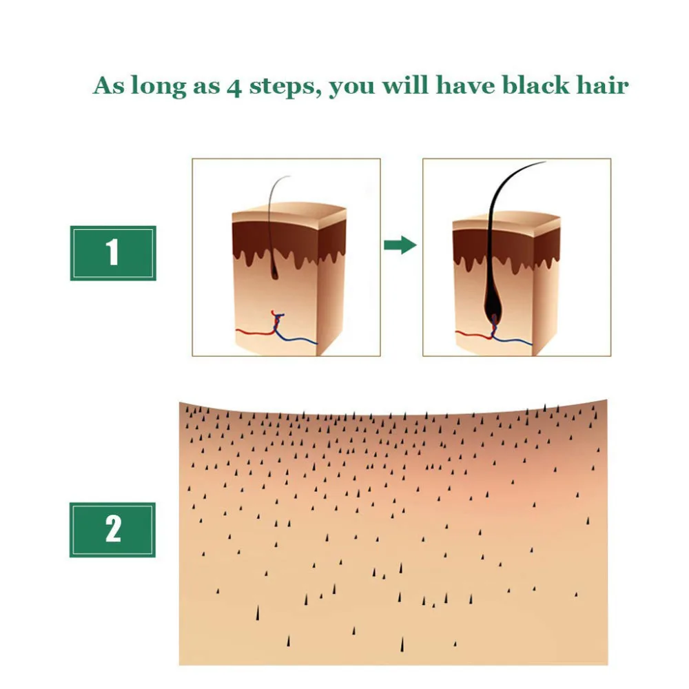 3 шт. удобрения для волос ускоренный рост волос жидкость средство для роста волос здоровая Сыворотка для волос ремонт растущий более быстрое лечение потери 3 шт