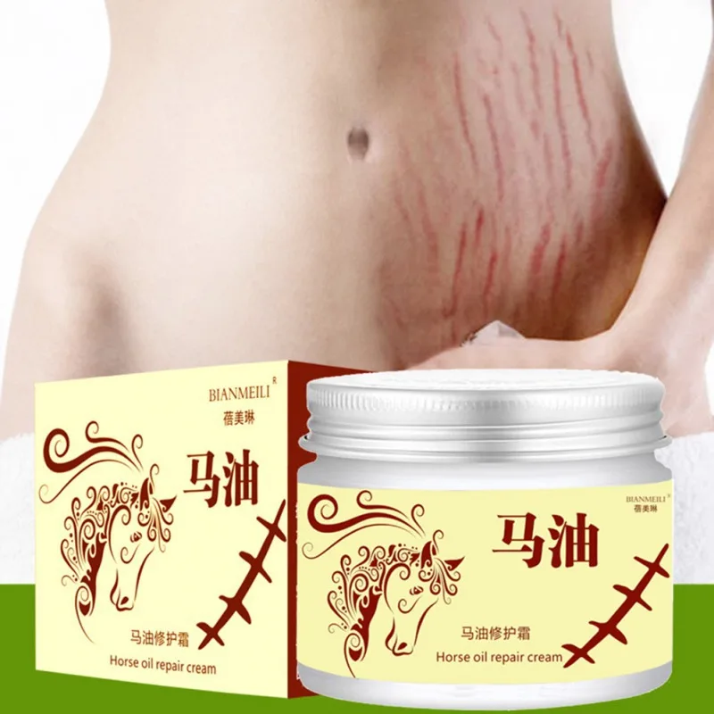 Horse Oil Repair Cream Remove Stretch Marks And Scars Lightening