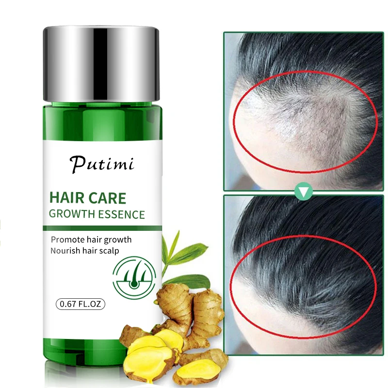 Putimi мощная сывороточная эссенция для роста волос для предотвращения выпадения волос продукты для удлинения более густых волос против облысения эссенция для роста волос