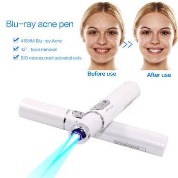 

Portable Blue Light Therapy Laser Pen Soft Scar Remover Wrinkle Removal Machine Varicose Veins Treatment Face Massager