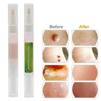 

Face Care Mole Removing Cream 15ml Wart Corns Dark Spot Remover Skin Tag Residue Treatment Professional Skin Repair Cream TSLM2