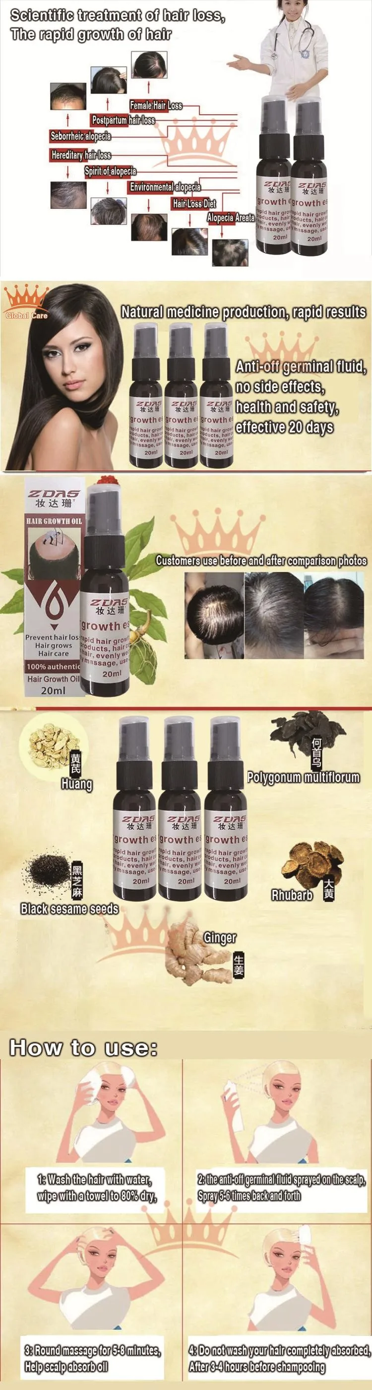 3bottle Hair Loss Chinese Herbal Polygonum l germinal dense hair liquid medicine fast hair growth agent seborrheic essential