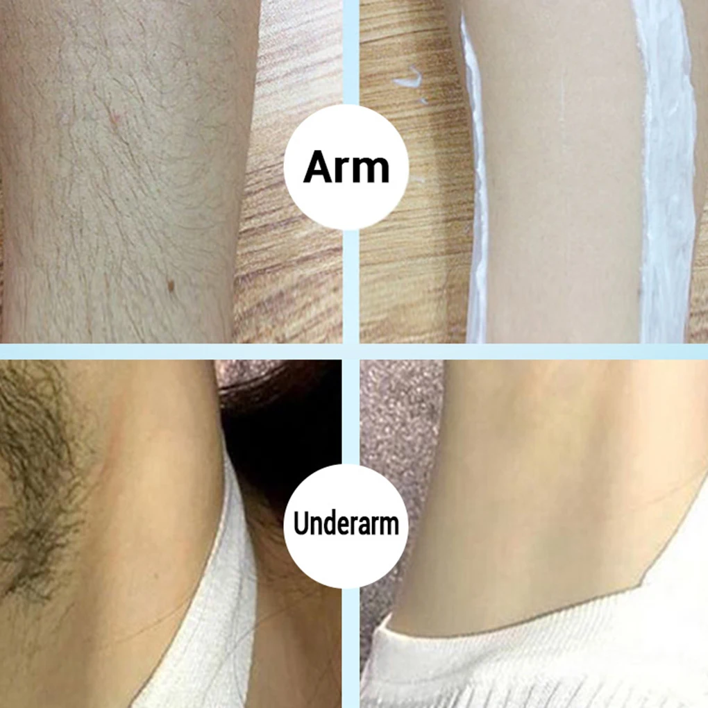 Hair Removal Cream Aloe Vera Vitamin C Mild Moisturizing Hand Leg Armpit Hair Loss Plaster