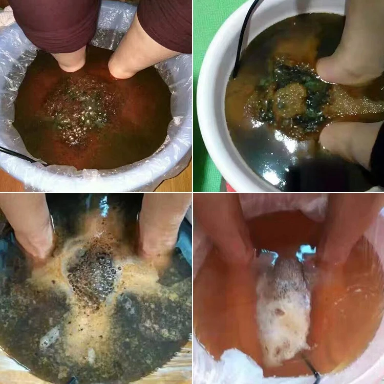 Аппарат для детоксикации ног 110 В 220 В|foot massage|health careion detox |