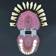  Dental Soft Gum Standad Typodont Study Model with 28pcs Removable Teeth #7008 