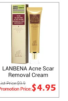 LANBENA Snail Repair отбеливающий крем для лица дневной крем против морщин и старения лечение акне, увлажнение подтяжка кожи уход за кожей 30g