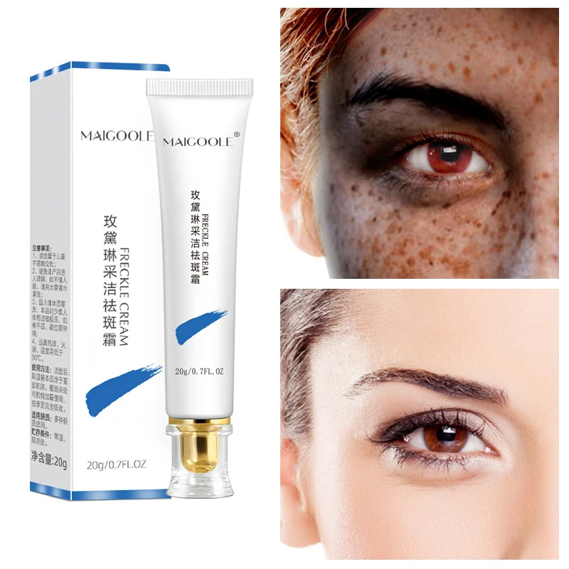 Powerful Whitening Freckle Cream Remove Melasma Acne Spot Pigment Melanin Dark Spots Pigmentation Moisturizing Gel Skin Care пигмент хайлайтер для лица pigment skin haghlighter pbl 1272 03 03 8 5 г