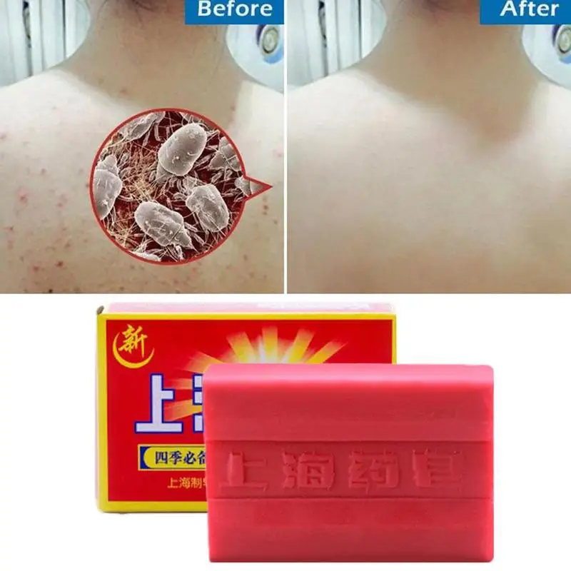 90 г красное китайское лекарственное мыло от акне, псориаза Себорея Eczema против грибка Ванна здоровое мыло Крем для тела для похудения|Мыло|   | АлиЭкспресс