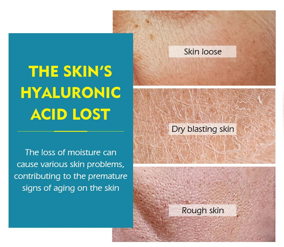 玻尿酸无水面膜_04