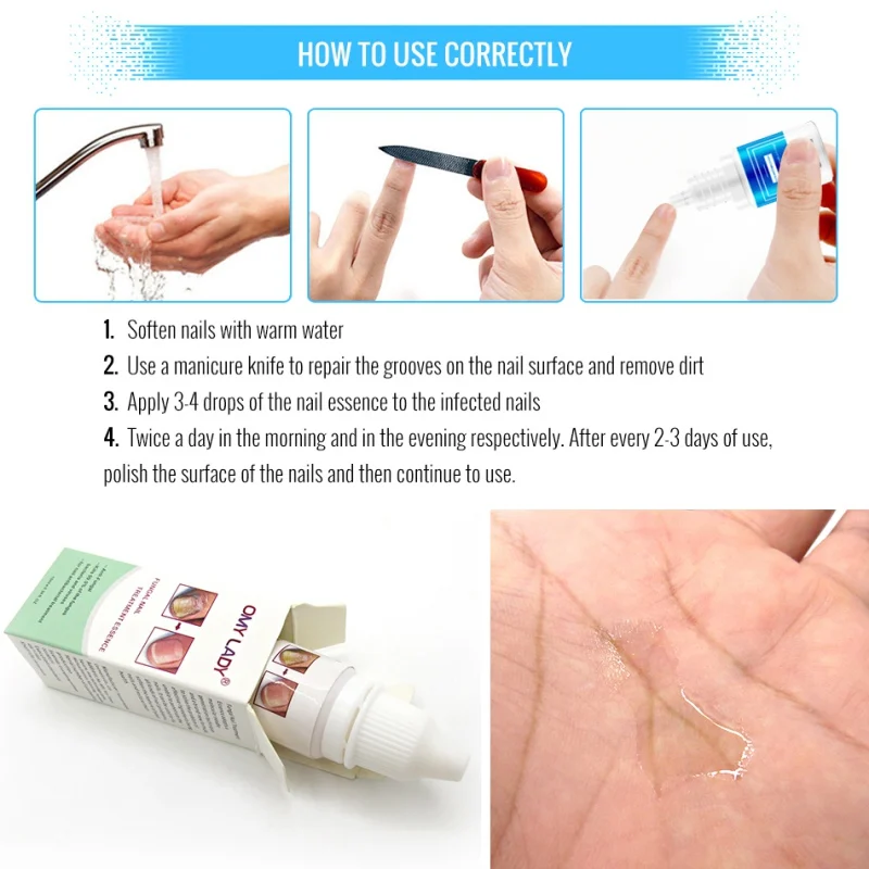 Средство для восстановления ногтей эффективно против грибка ногтей ...