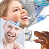 Dental Hygiene Tool Sickle Shape Dentist Tartar Scraper Scaler Dental Equipment Calculus Plaque Remover Teeth Cleaning Oral Care ► Photo 3/6
