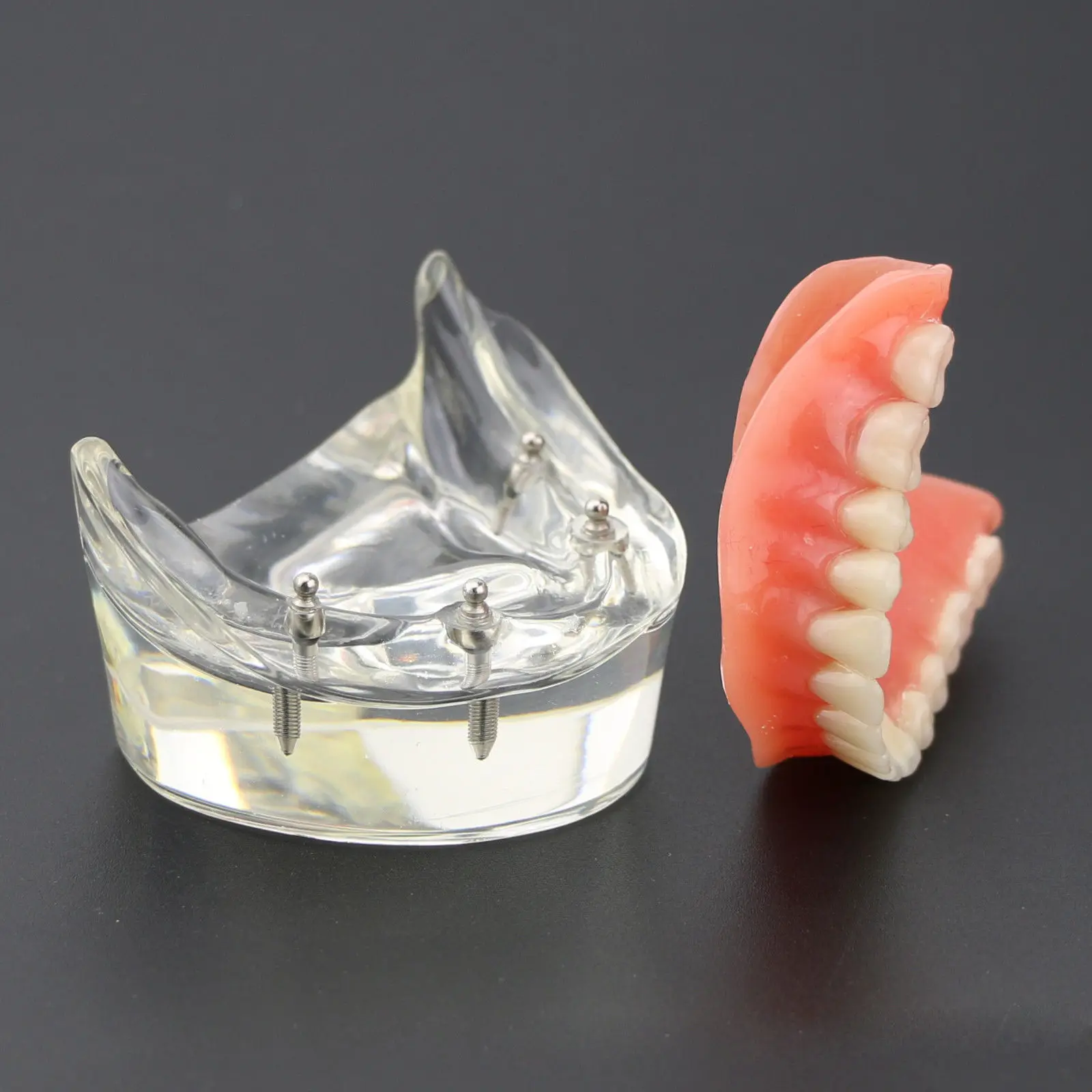 Goede 1Pc Dental Tanden Studie Model Overdenture Inferior 4 Implant Demo Model 6002 02