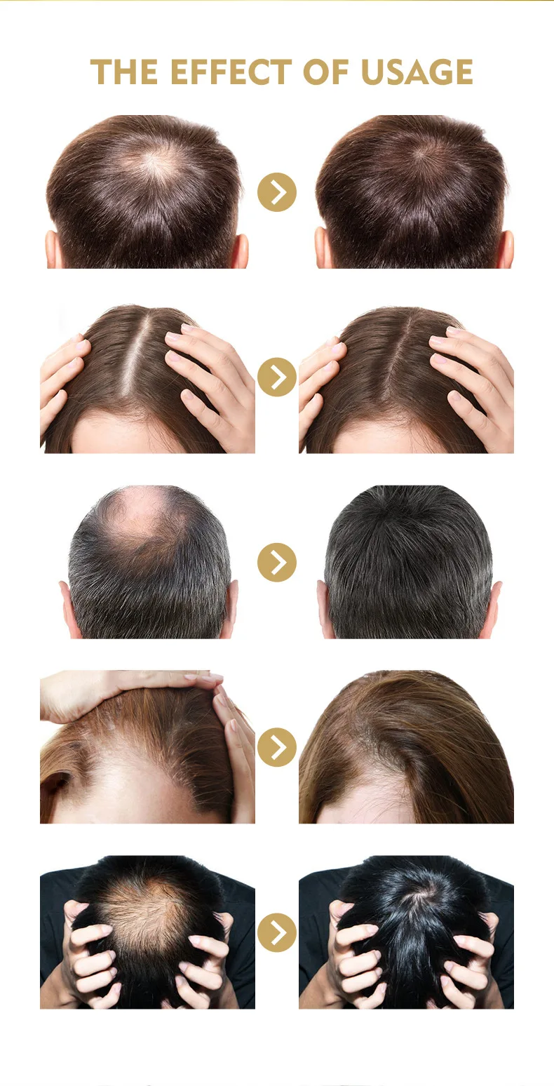 Hair Care Hair Growth Products Fast Growing Hair Oil Hair Loss Care Liquid Beauty Hair &Amp; Scalp Treatment Dense Hair Growth Serum