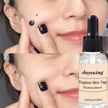 

Mighty Tag & Spots Remover Serum 20ml Painless Mole Skin Dark Spot Mole Removal Face Wart Tag Freckle Skin Tag Removal Serum