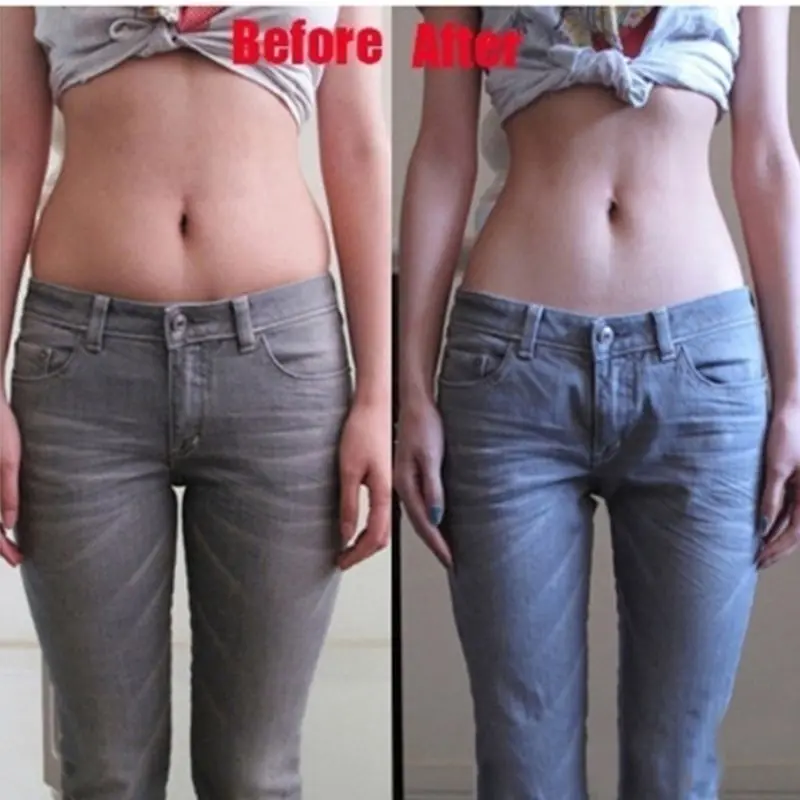 Пластыри для похудения с наклейкой на пупок 10 шт./коркор.|Товары похудения| |