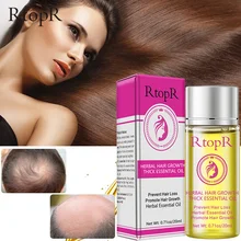 Os óleos essenciais ervais da anti perda do cabelo podem eficazmente promover o crescimento rápido do cabelo e o frizz liso. Óleos essenciais para o cabelo 20ml
