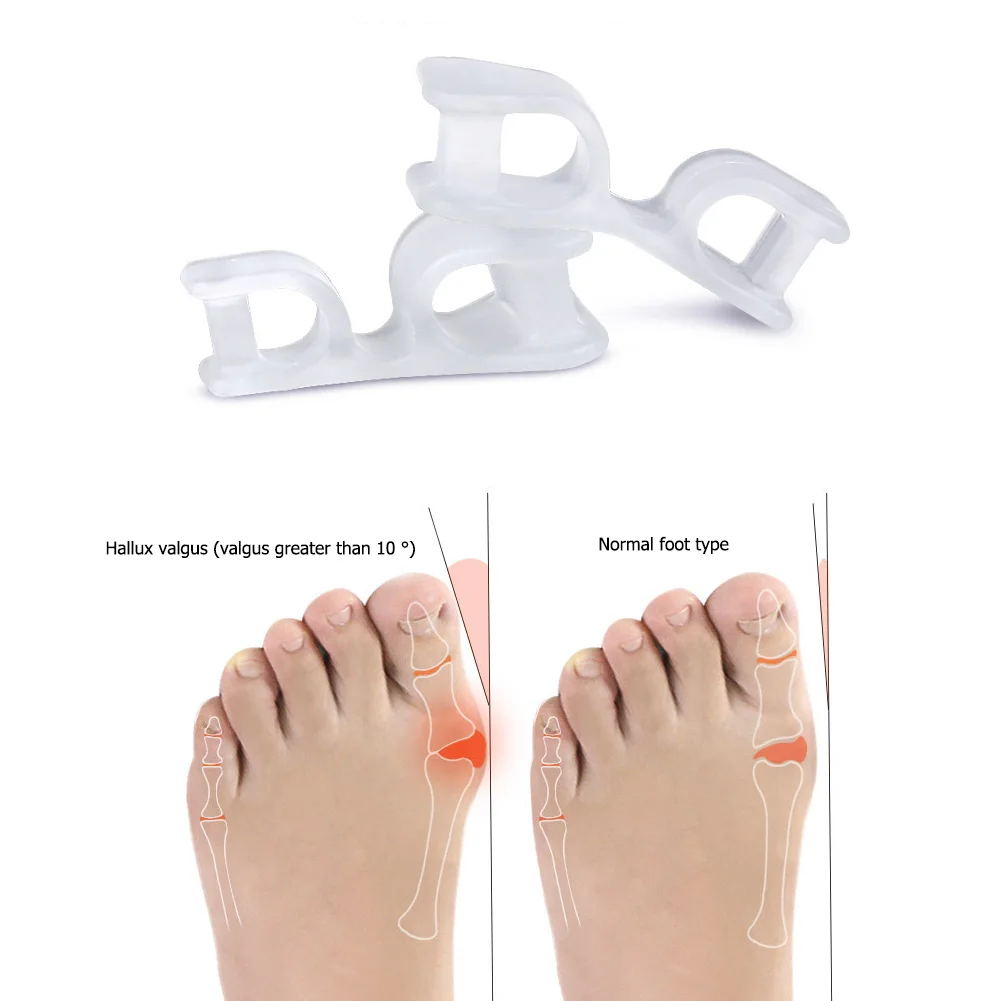 1 Pair Toe Separator Straightener Bunion Hallux Valgus Orthosis Overlapping Correctors Pain Relief Nail Art Manicure Tools