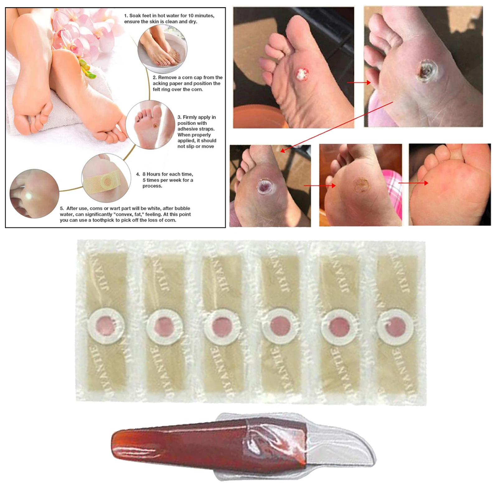 Pro Feet Corn Plaster Wart Sticker Adhesive Toe Corn Callus Removal with Knife Effective Corn Treatment Pads Corn Remover Pads Pro Feet Corn Plaster Wart Sticker Adhesive Toe Corn Callus Removal with Knife Effective Corn Treatment Pads Corn Remover Pads