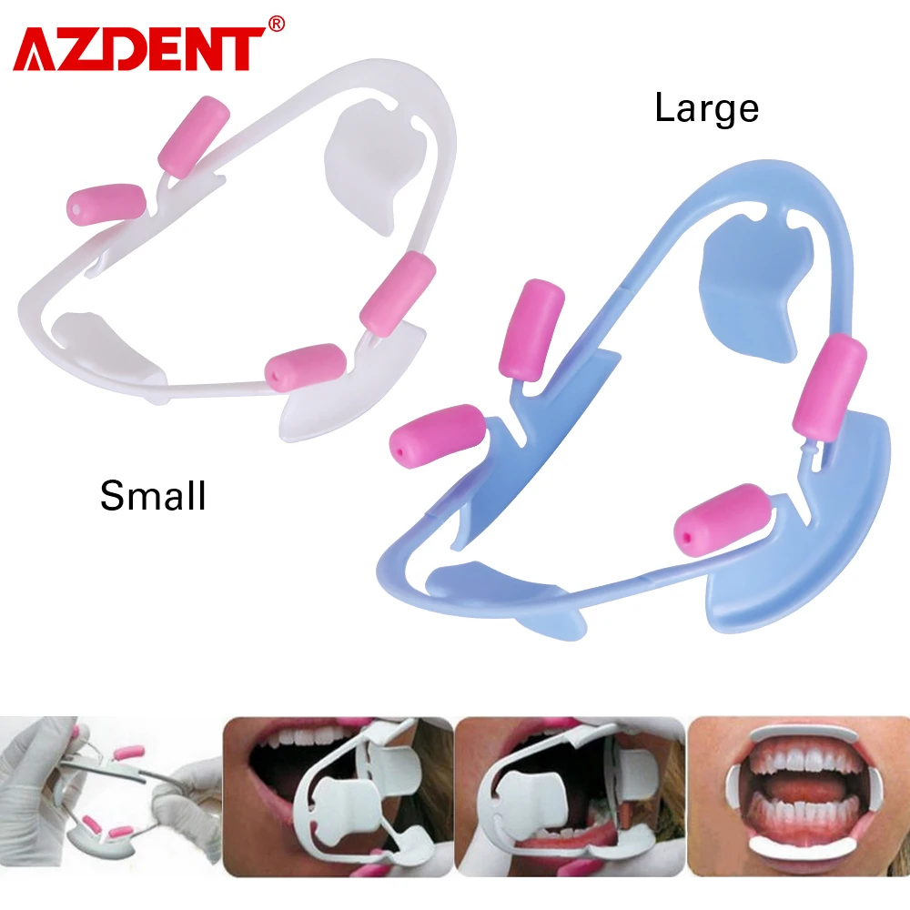 Apri divaricatore per labbra divaricatore per labbra a forma di O in plastica 3 pezzi per clinica odontoiatrica per dentista per esame orale per odontoiatria 