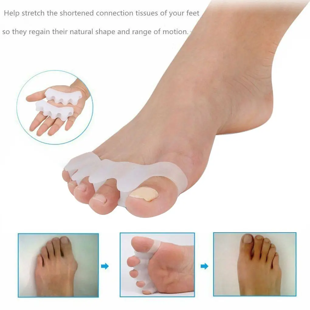 Silicone Toe Separator Correction Hallux Valgus Corrector Orthopedic Hammer Separator Straightener Spreader Foot Care Tool 2PCS