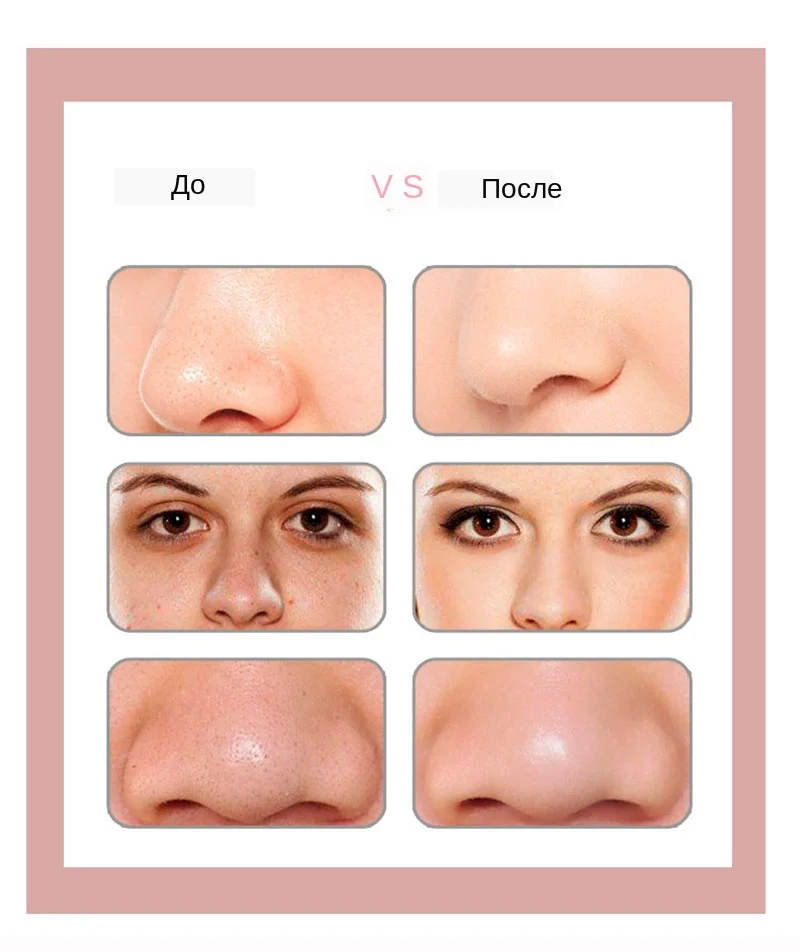 详情_Hc3af6718141f4c8d9d2c2cead5f25ef2A