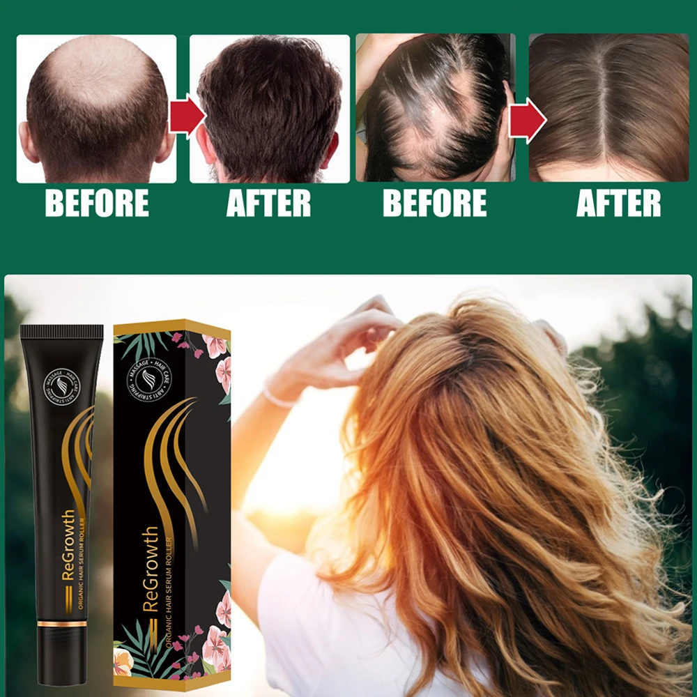 Regrowth Organic Hair Serum Roller Set Biotin Hair Growth Serum Triple  Roll-On Massager Hair Growth Essence for All Hair Types _ - AliExpress  Mobile