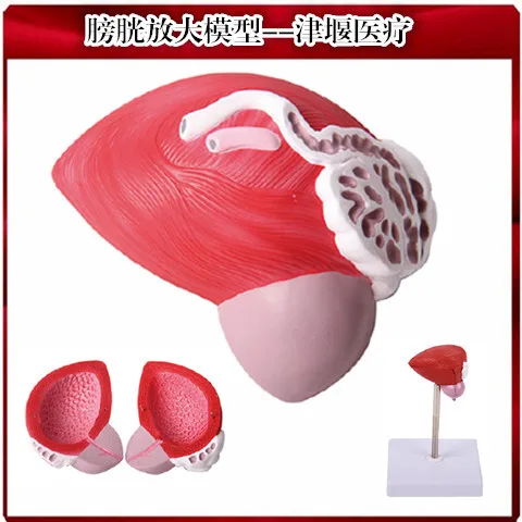 1-1-life-sized-human-anatomica-bladder-prostate-model-urethral-uretheric-vas-deferens-seminal-glands-ejaculatory-ducts