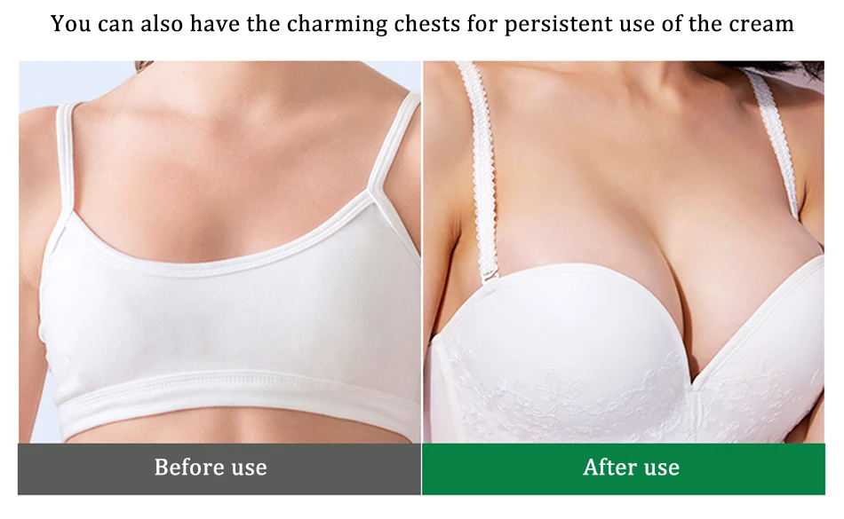 OMY LADY крем для увеличения груди, Лечение увеличения груди, привлекательный лифтинг груди для более полной груди, женский уход за телом, 100 г