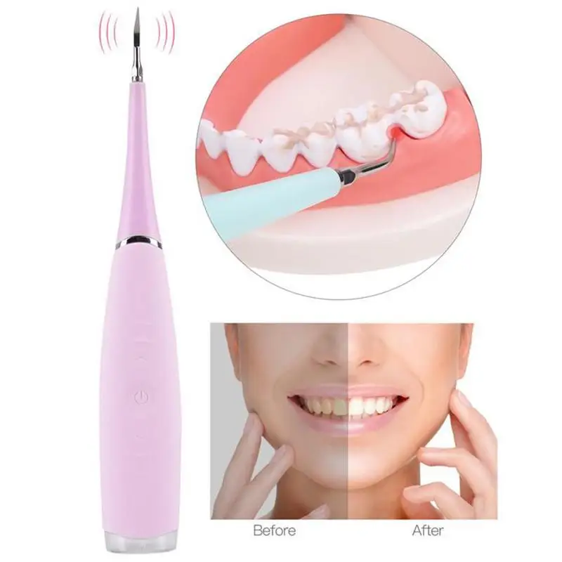 Portable Electric Sonic Dental Tooth Calculus Remove Stains Tartar Tool Dentist Whiten Teeth Health Oral Hygiene 5