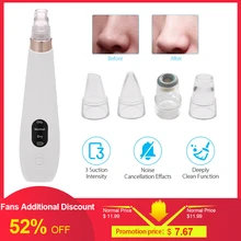 Blackhead Remover Vacuum Facial Pore Dot Blackhead Cleaner Electronic LED Display Extraction Kit Black Dot Head Remover Tools