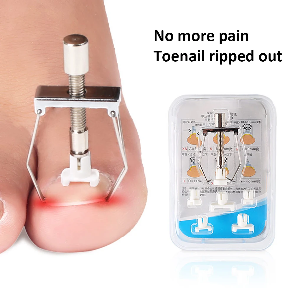 Купить Педикюрный Набор Для Ногтей На Ногах