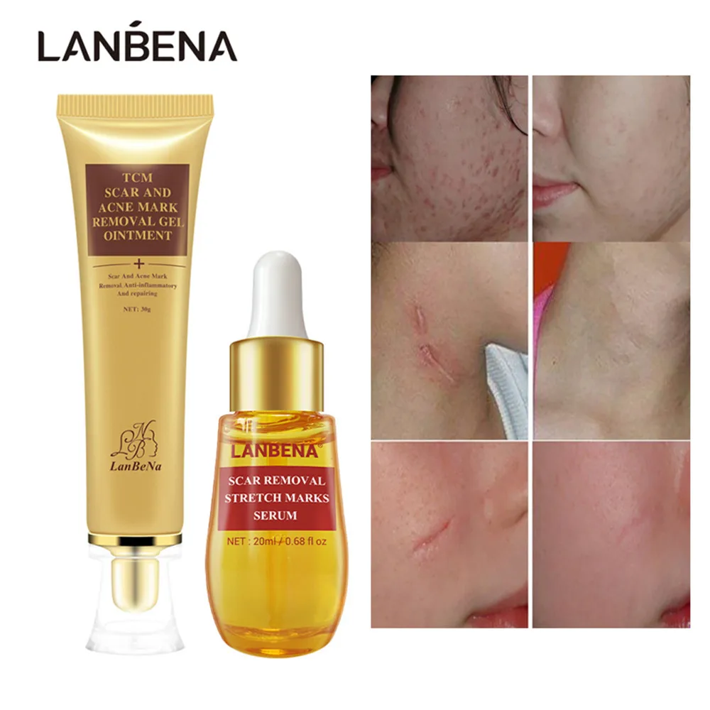 lanbena for stretch marks