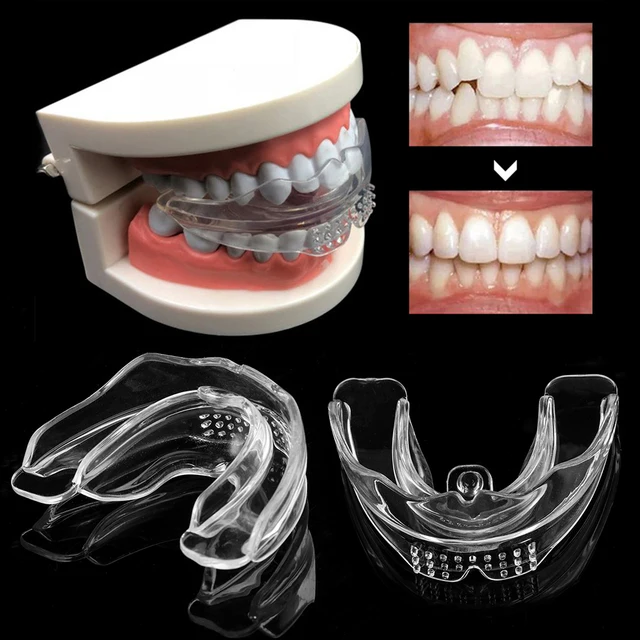 Ортодонтические ортодонтические скобы, 1 шт., ортодонтические скобы для защиты от бруксизма, для красоты полости рта, унисекс, защита для рта 1