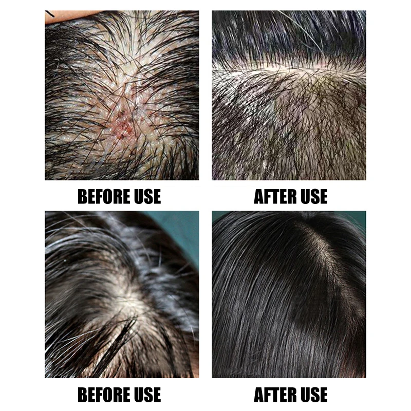 Sea Salt Anti-Dandruff Shampoo Cream Relieve Itching Control Oil Hair Shampoos Hair Care @ME88 Sea Salt Anti-Dandruff Shampoo Cream Relieve Itching Control Oil Hair Shampoos Hair Care @ME88