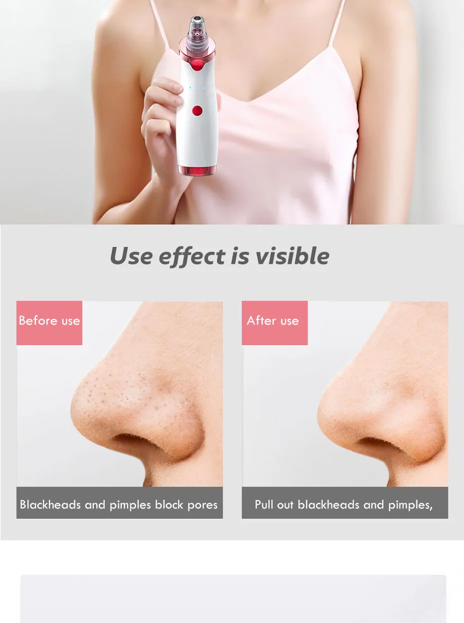 H198d15a2000644e2ac41d927e71f7a69N Microdermabrasion Blackhead Remover Vacuum Suction Face Pimple Acne Comedone Extractor Facial Pores Cleaner Skin Care Tools 38