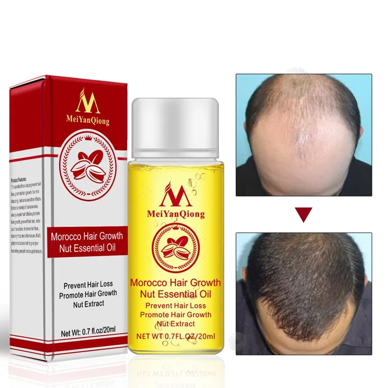 Марокканское масло для волос масло для роста против выпадения волос средство для предотвращения выпадения волос продукты для ухода за волосами эфирное масло ореха