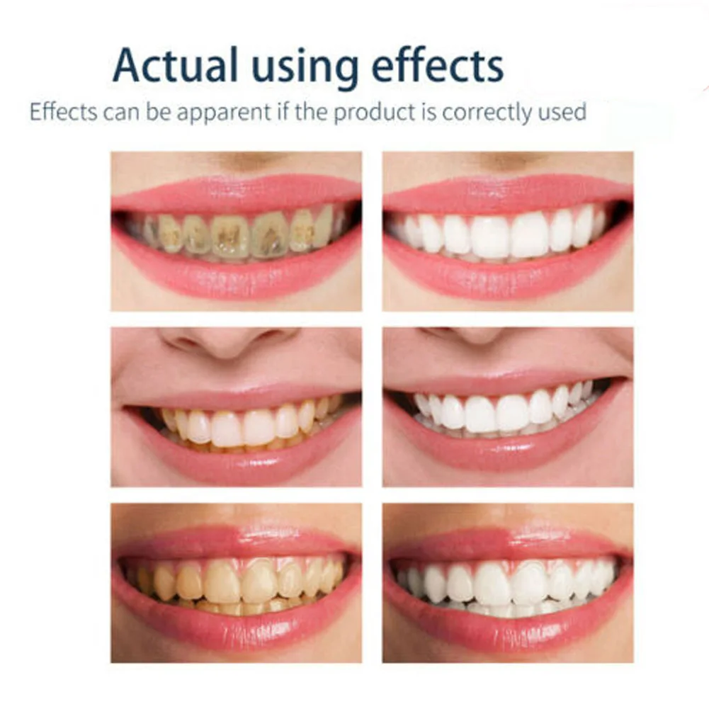 1 2Pcs Fresh Shining Tooth Cleaning Mousse Toothpaste Oral Hygiene Health Care QS888 3