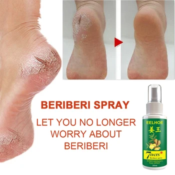 

20/30/50ml Athlete's Foot Odor Sweat Foot Cream Treatment Peeling Feet Erosive Water Sprays SEC88