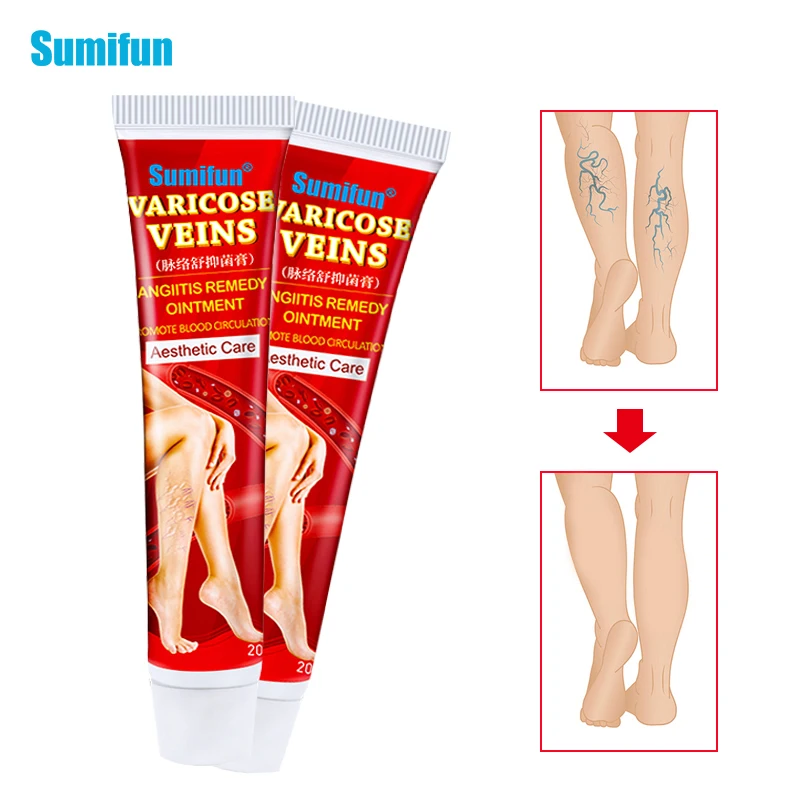 

Sumifun 1/2pcs New Varicose Veins Treatment Cream 100% Original Vasculitis Phlebitis Spider Pain Relief Ointment Medical Plaster